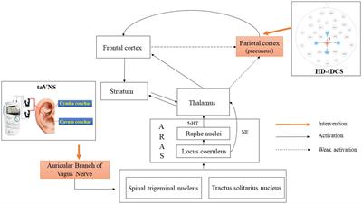 Effects of simultaneous transcutaneous auricular vagus nerve stimulation and high-definition transcranial direct current stimulation on disorders of consciousness: a study protocol